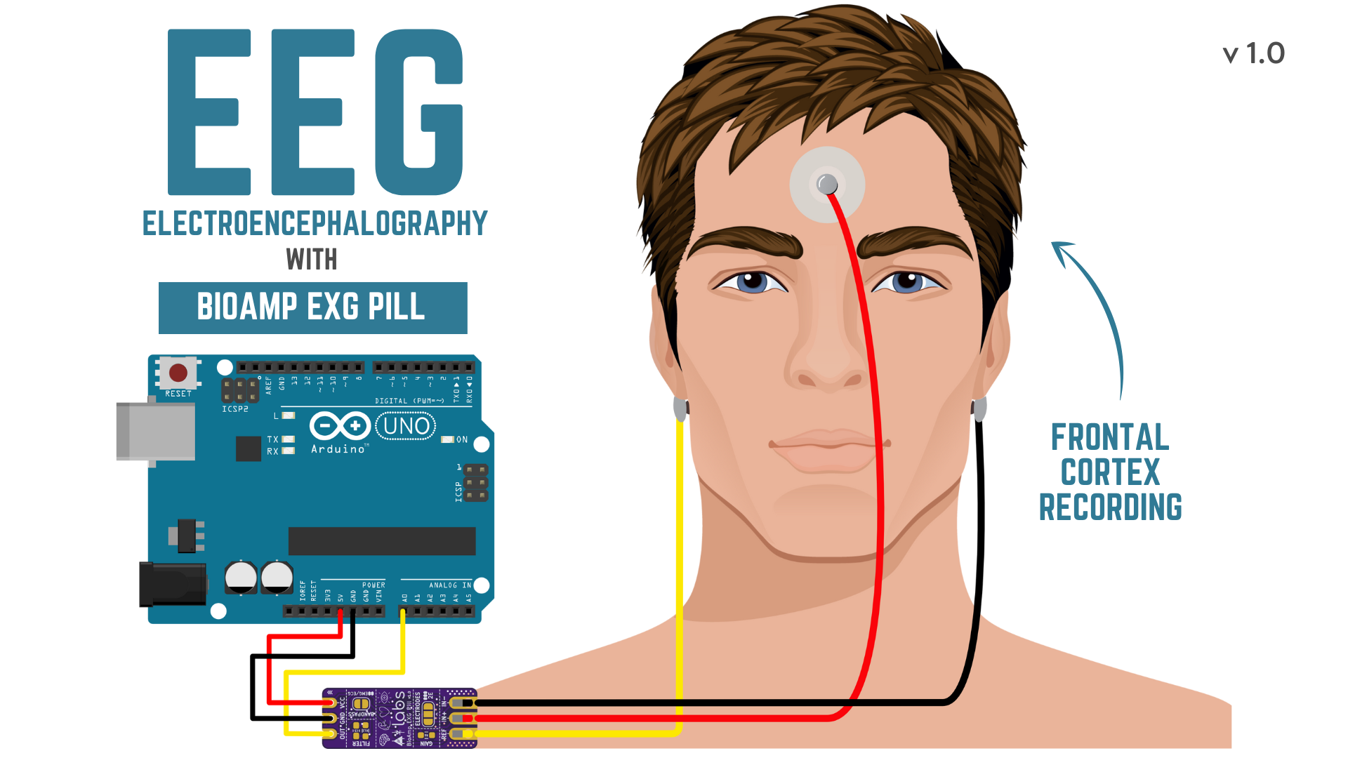 Penempatan elektroda gel EEG