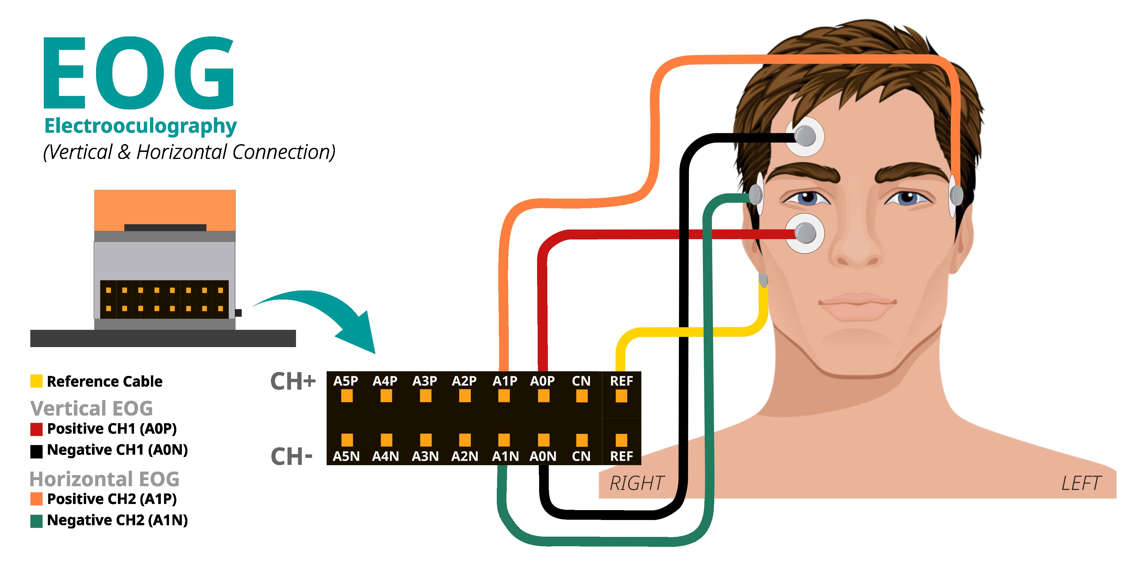 Electrode Placement Diagram