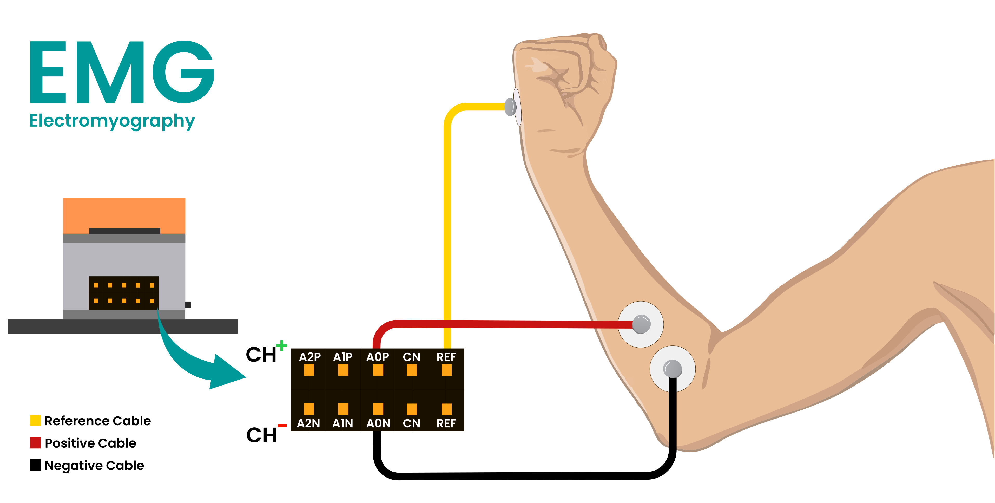 Connection for EMG