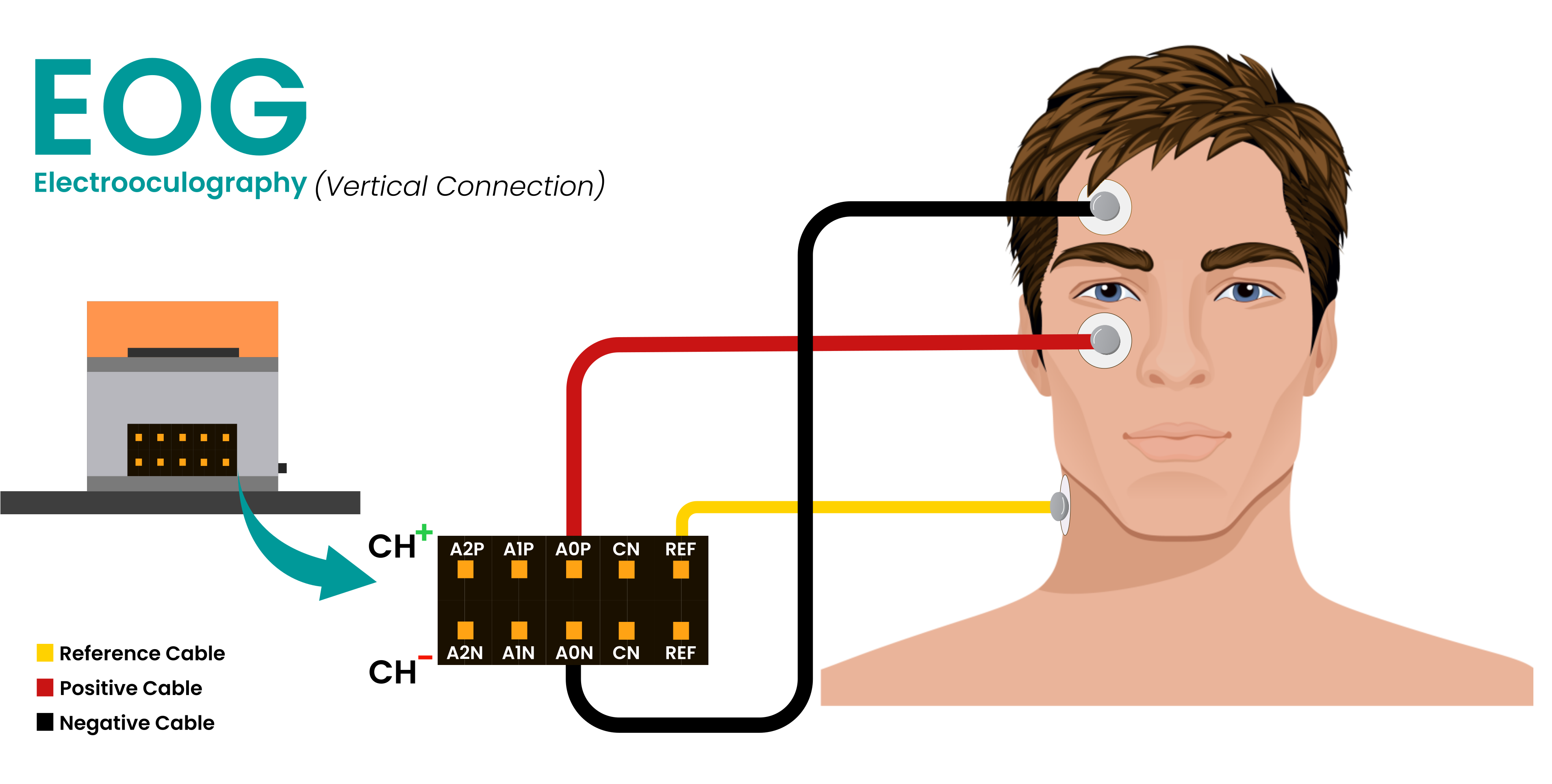 Connection for EOG Vertical